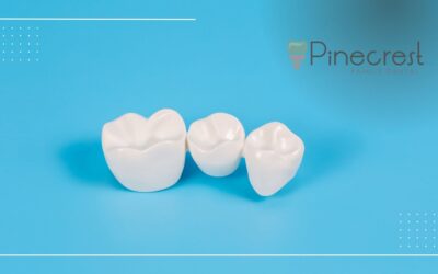 5 Signs You May Need Dental Crowns