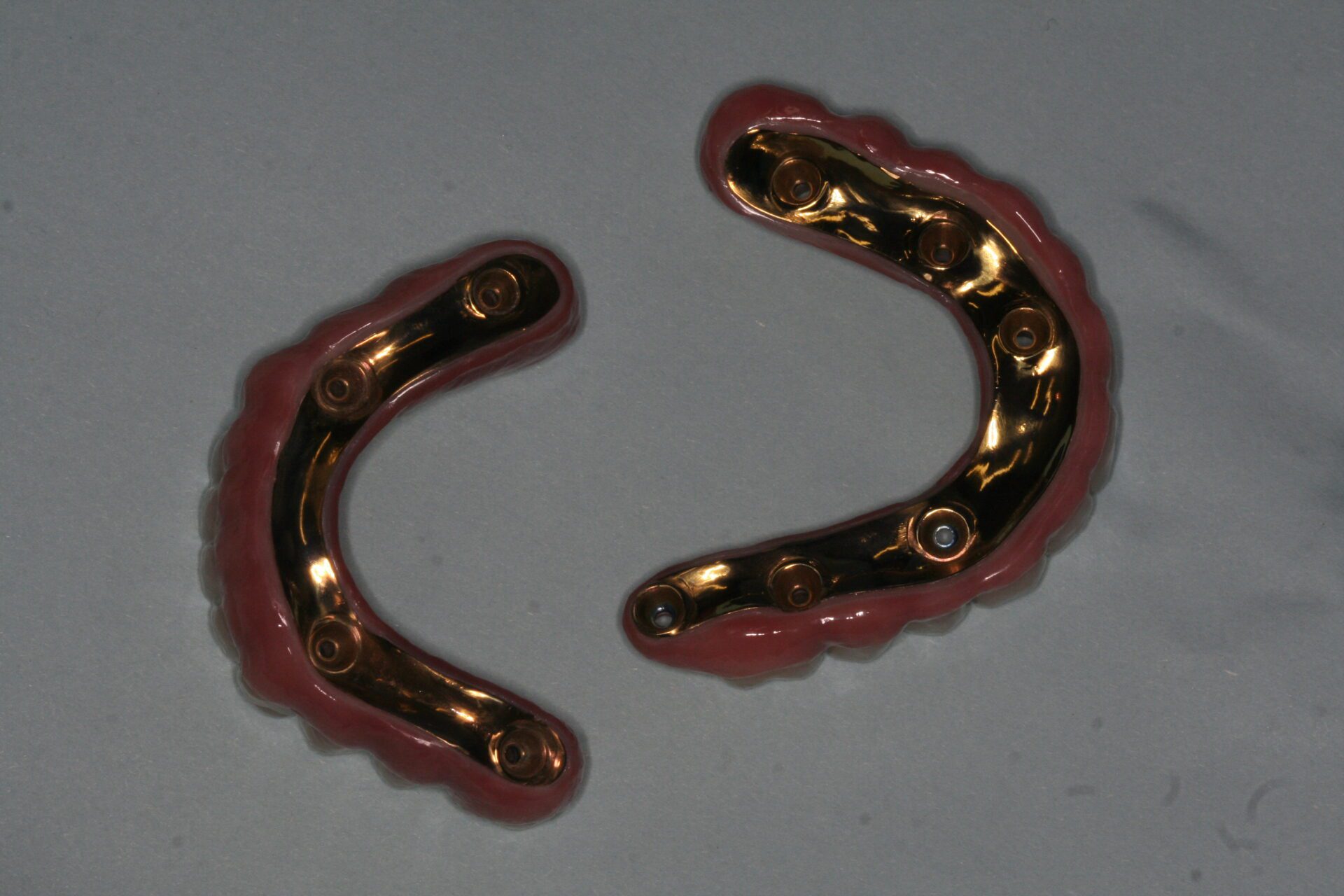 Oral Rehabilitation Case 3